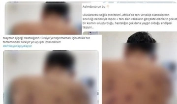 Cumhurbaşkanlığından 'maymun çiçeği' açıklaması